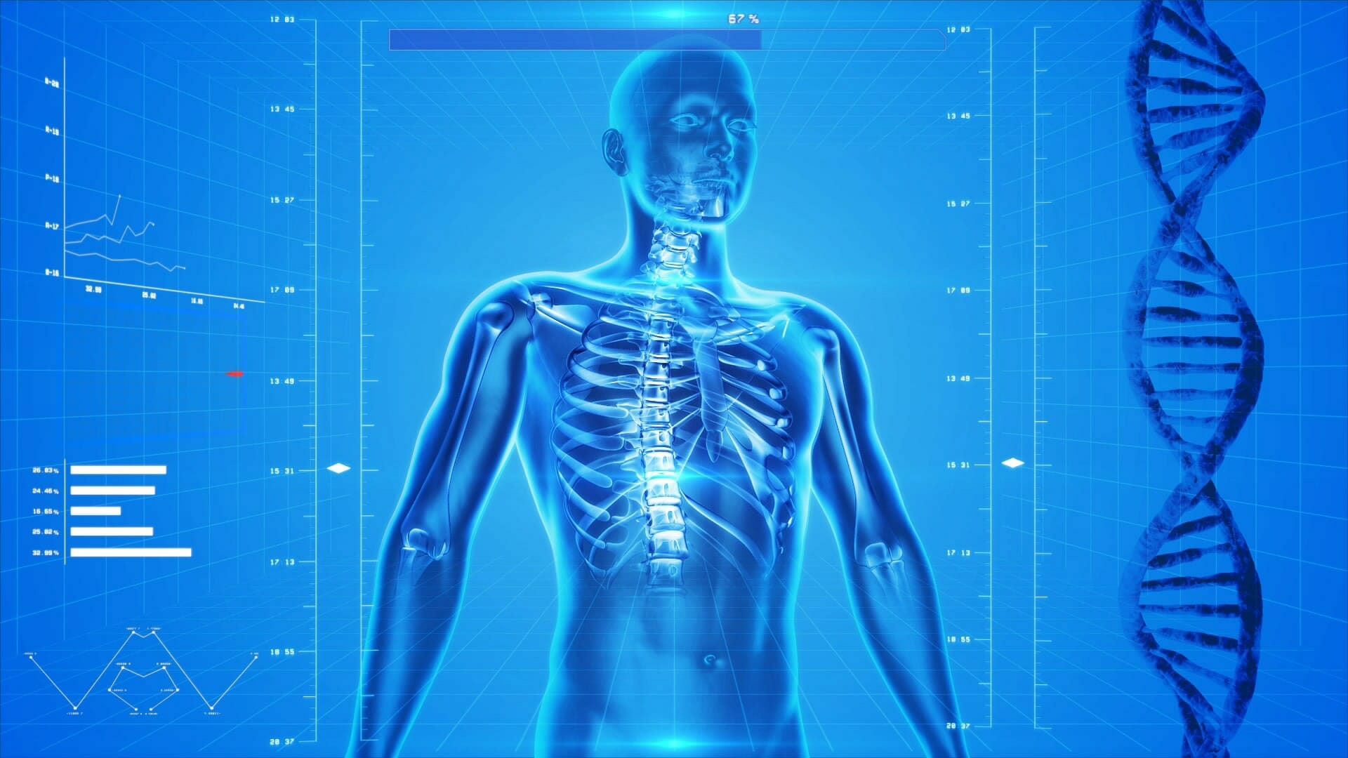 Anatomy of a Cyberattack featured image, CC0 license, pixabay.com